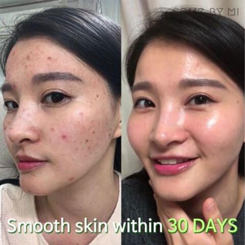 Some by mi AHA BHA pha 30 days miracle Serum 50 ML.
