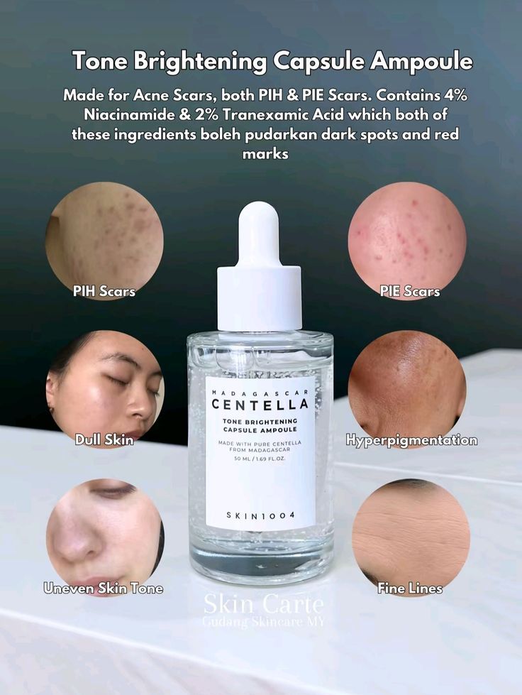 Skin 1004 Centella Tone Brightening Capsule Ampoule 100 ML